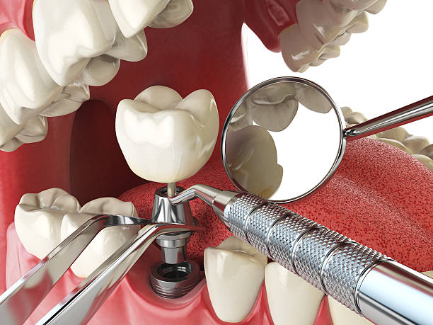 Best Emergency Dentist for Knocked-Out Tooth in Helena West Helena, AR